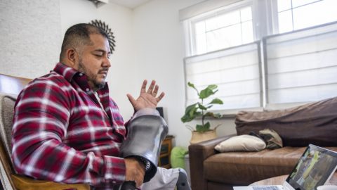 An American veteran double amputee on a telemedicine call with his doctors at home