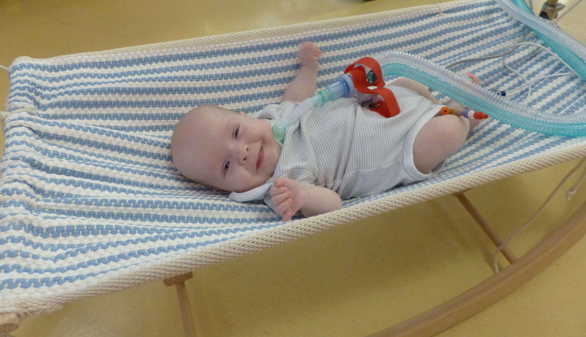 Das Baby Bianca mit Beatmungsschlauch am Schaukeln