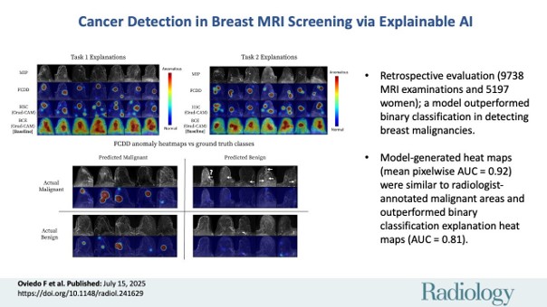 Imágenes de resonancias magnéticas para la detección de cáncer de mama