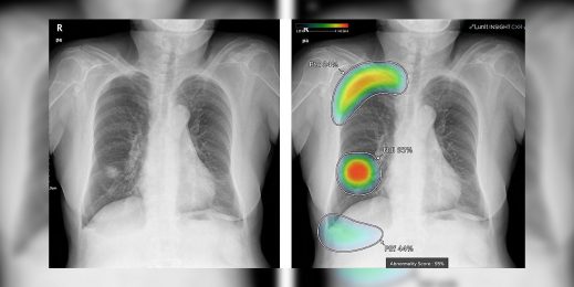 (Изображение: Lunit)