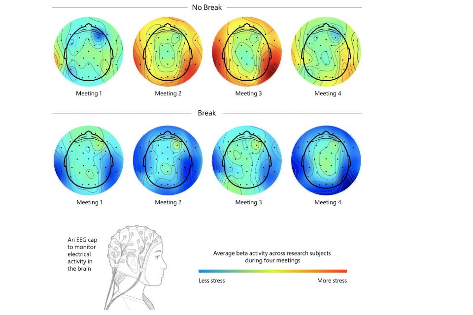 Brain scans